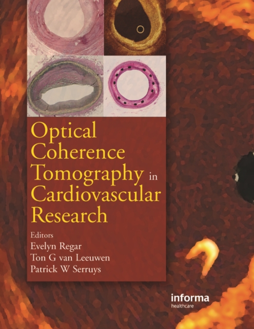 Optical Coherence Tomography in Cardiovascular Research, PDF eBook