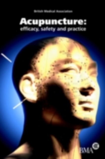 Acupuncture: Efficacy, Safety and Practice : Efficacy, Safety and Practice, PDF eBook