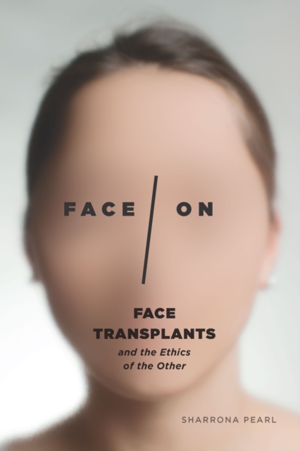 Face/On : Face Transplants and the Ethics of the Other, EPUB eBook