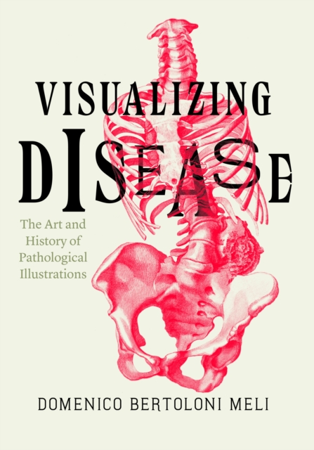 Visualizing Disease : The Art and History of Pathological Illustrations, EPUB eBook