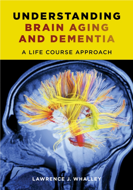 Understanding Brain Aging and Dementia : A Life Course Approach, EPUB eBook