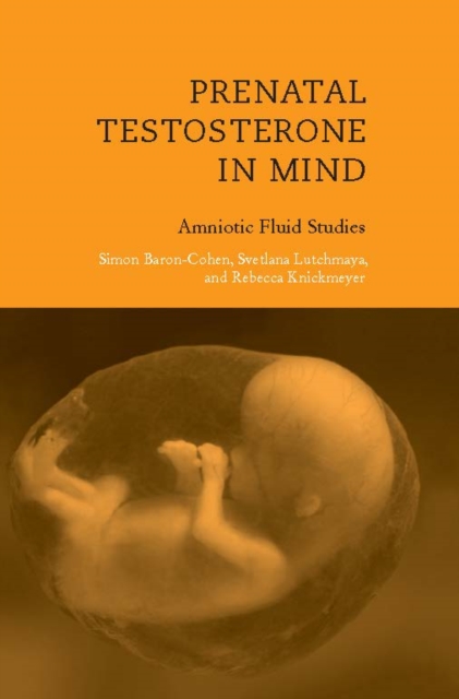 Prenatal Testosterone in Mind : Amniotic Fluid Studies, PDF eBook