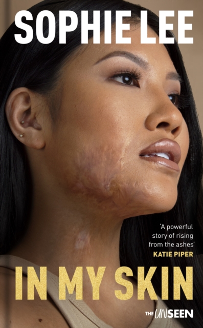 In My Skin : Learning to love your perfectly imperfect life, Hardback Book