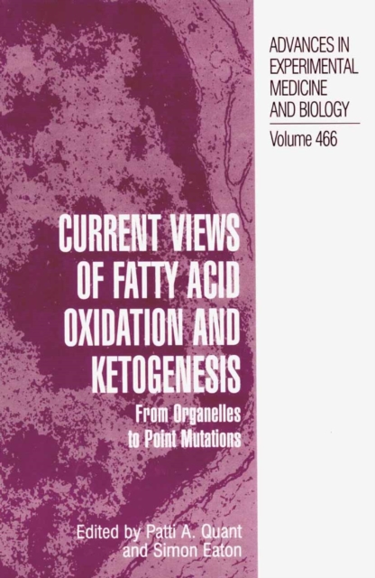 Current Views of Fatty Acid Oxidation and Ketogenesis : From Organelles to Point Mutations, PDF eBook