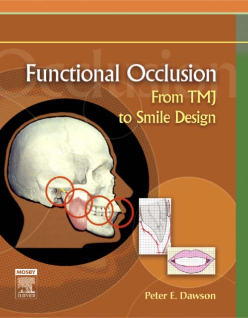 Functional Occlusion : From TMJ to Smile Design, Hardback Book
