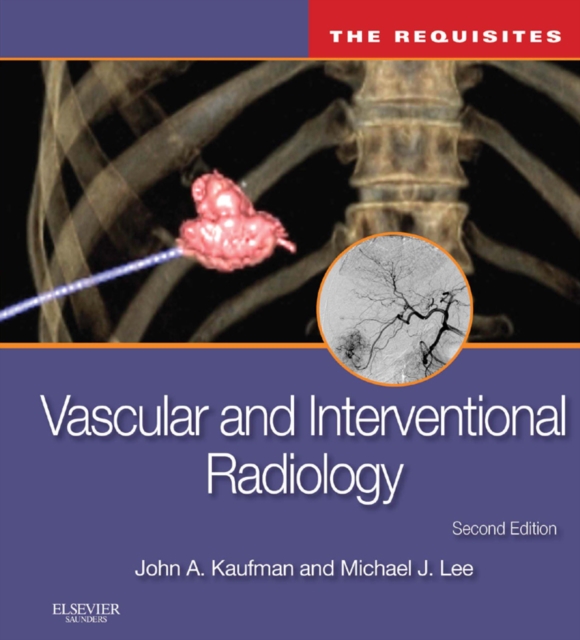 Vascular and Interventional Radiology: The Requisites E-Book : Vascular and Interventional Radiology: The Requisites E-Book, EPUB eBook