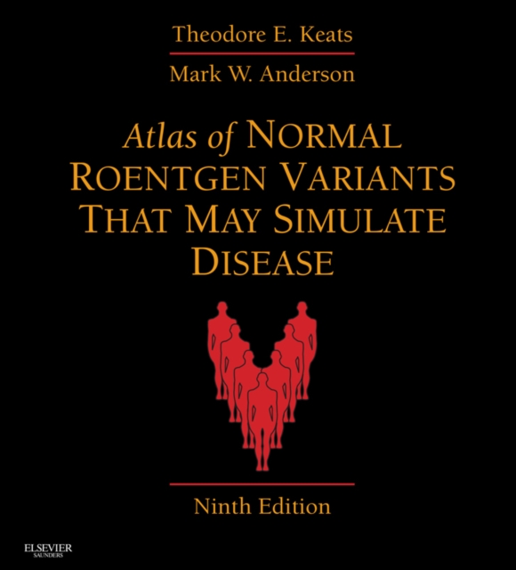 Atlas of Normal Roentgen Variants That May Simulate Disease E-Book : Expert Consult - Enhanced Online Features and Print, EPUB eBook
