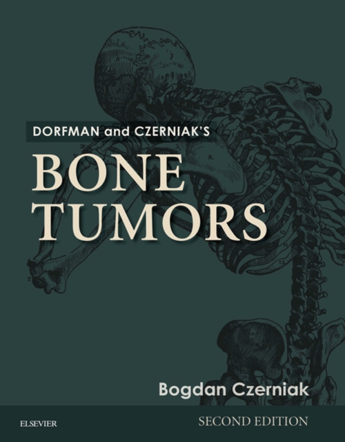 Dorfman and Czerniak's Bone Tumors E-Book, EPUB eBook