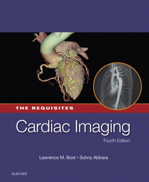 Cardiac Imaging: The Requisites E-Book : Cardiac Imaging: The Requisites E-Book, EPUB eBook