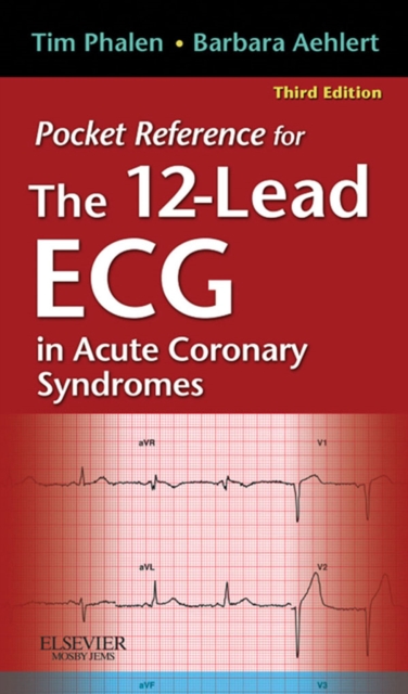 Pocket Reference for The 12-Lead ECG in Acute Coronary Syndromes - E-Book : Pocket Reference for The 12-Lead ECG in Acute Coronary Syndromes - E-Book, EPUB eBook