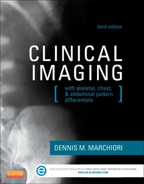 Clinical Imaging : With Skeletal, Chest, & Abdominal Pattern Differentials, EPUB eBook