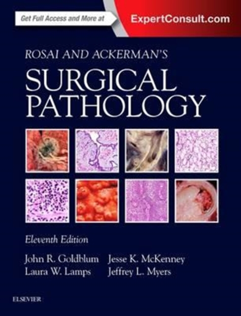 Rosai and Ackerman's Surgical Pathology - 2 Volume Set, Hardback Book