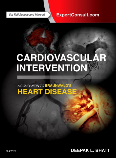 Cardiovascular Intervention: A Companion to Braunwald's Heart Disease E-Book, EPUB eBook