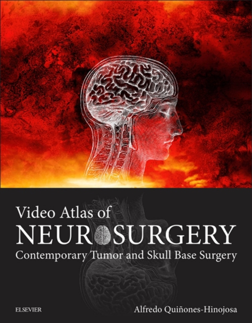 Video Atlas of Neurosurgery E-Book : Video Atlas of Neurosurgery E-Book, EPUB eBook