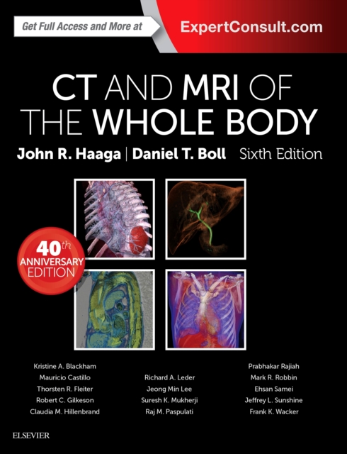 Computed Tomography & Magnetic Resonance Imaging Of The Whole Body E-Book, EPUB eBook