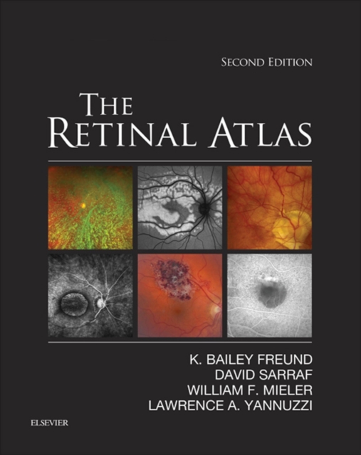 The Retinal Atlas E-Book, EPUB eBook