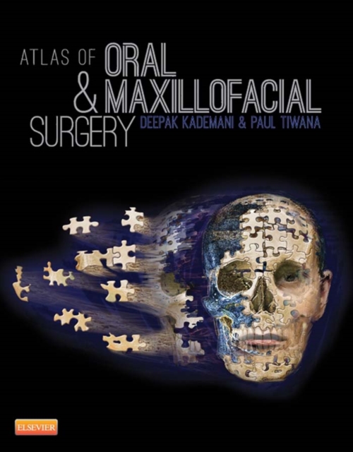 Atlas of Oral and Maxillofacial Surgery, EPUB eBook