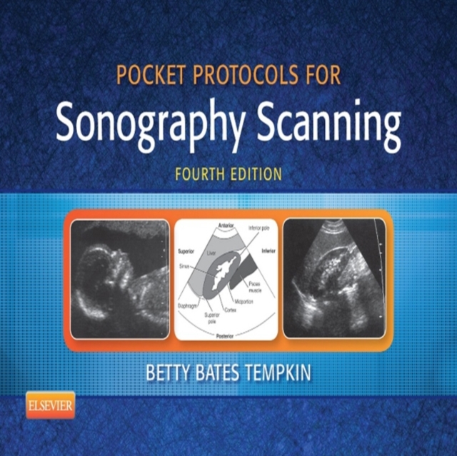 Pocket Protocols for Sonography Scanning, EPUB eBook