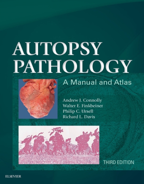 Autopsy Pathology: A Manual and Atlas E-Book, EPUB eBook