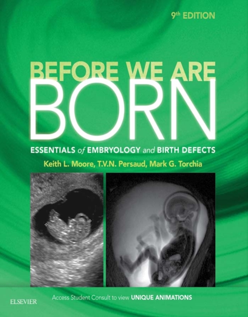 Before We Are Born E-Book : Essentials of Embryology and Birth Defects With STUDENT CONSULT Online Access, EPUB eBook