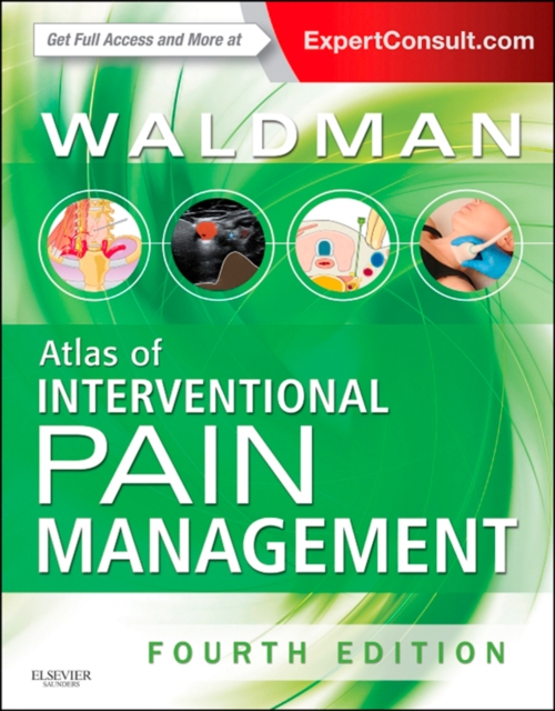 Atlas of Interventional Pain Management E-Book, EPUB eBook