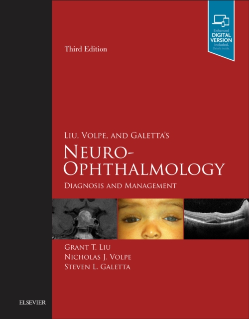 Liu, Volpe, and Galetta's Neuro-Ophthalmology E-Book : Diagnosis and Management, EPUB eBook