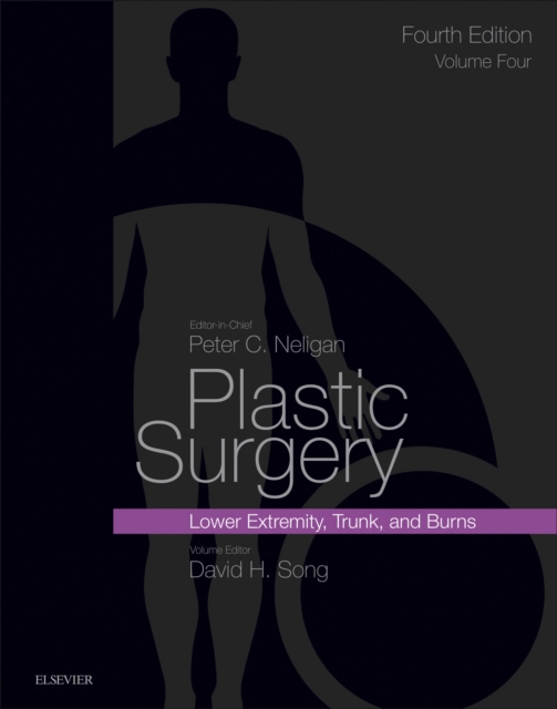 Plastic Surgery : Volume 4: Trunk and Lower Extremity, EPUB eBook