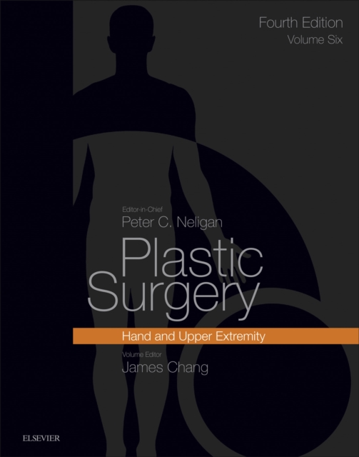 Plastic Surgery E-Book : Volume 6: Hand and Upper Limb, EPUB eBook