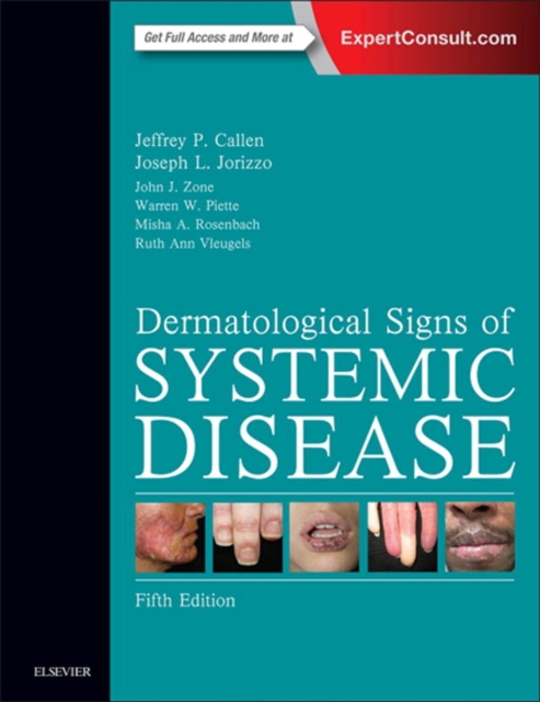Dermatological Signs of Systemic Disease E-Book, EPUB eBook