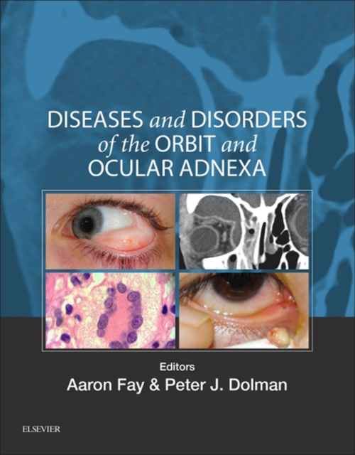 Diseases and Disorders of the Orbit and Ocular Adnexa E-Book : Expert Consult, EPUB eBook