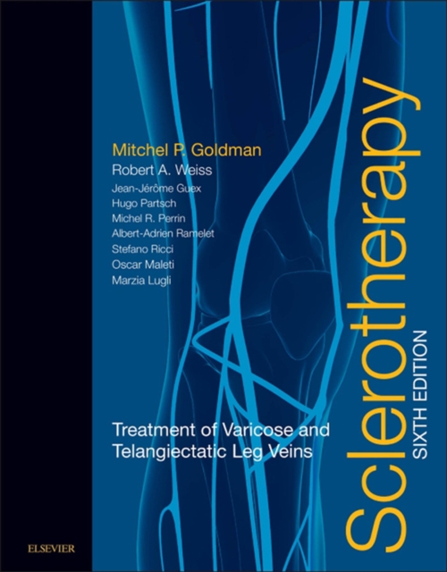 Sclerotherapy E-Book : Treatment of Varicose and Telangiectatic Leg Veins (Expert Consult), EPUB eBook