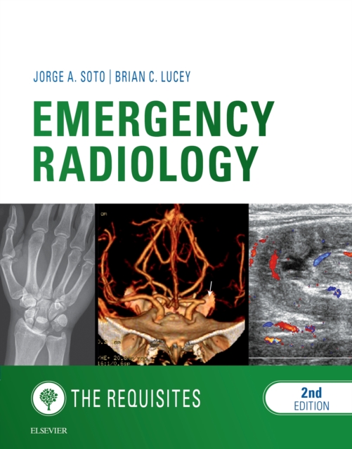 Emergency Radiology: The Requisites E-Book, EPUB eBook