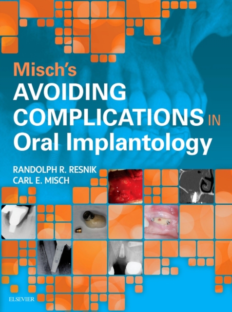 Misch's Avoiding Complications in Oral Implantology, EPUB eBook