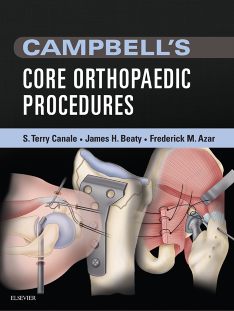 Campbell's Core Orthopaedic Procedures, EPUB eBook