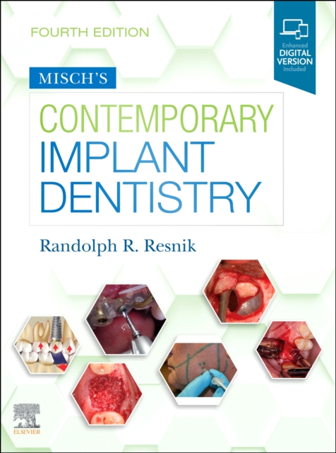 Misch's Contemporary Implant Dentistry, Hardback Book