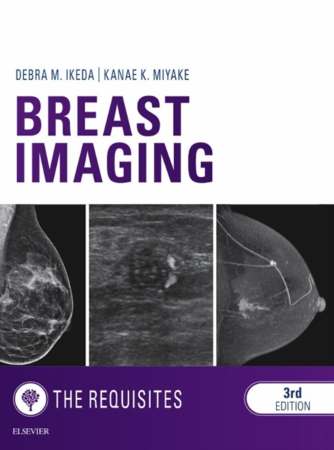 Breast Imaging: The Requisites E-Book : Breast Imaging: The Requisites E-Book, EPUB eBook