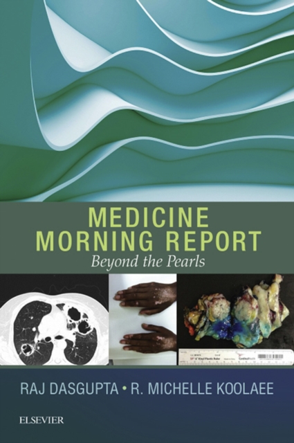 Medicine Morning Report: Beyond the Pearls E-Book : Medicine Morning Report: Beyond the Pearls E-Book, EPUB eBook