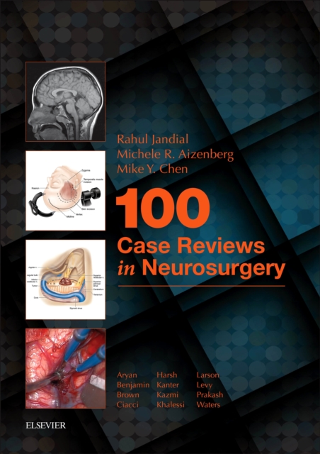 100 Case Reviews in Neurosurgery E-Book, EPUB eBook