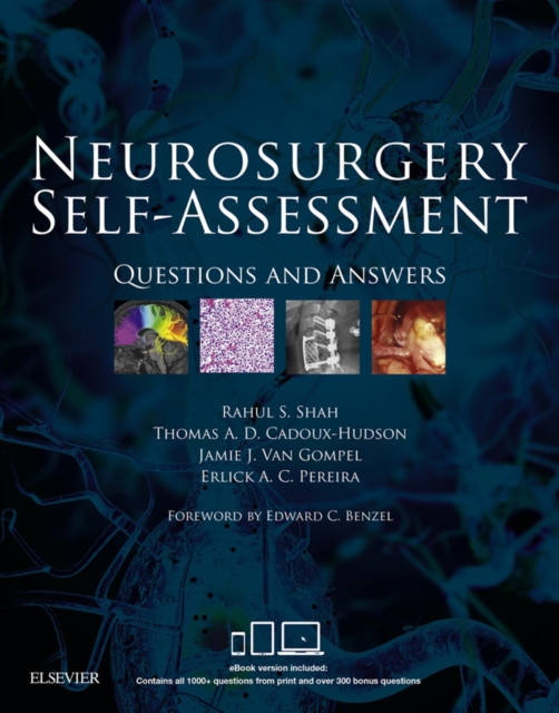Neurosurgery Self-Assessment E-Book : Questions and Answers, EPUB eBook