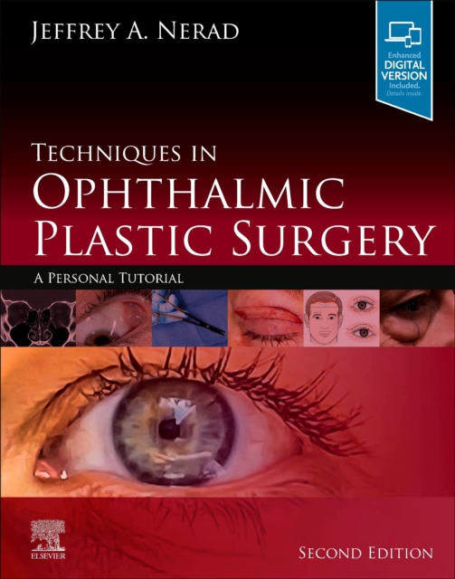 Techniques in Ophthalmic Plastic Surgery : A Personal Tutorial, Hardback Book