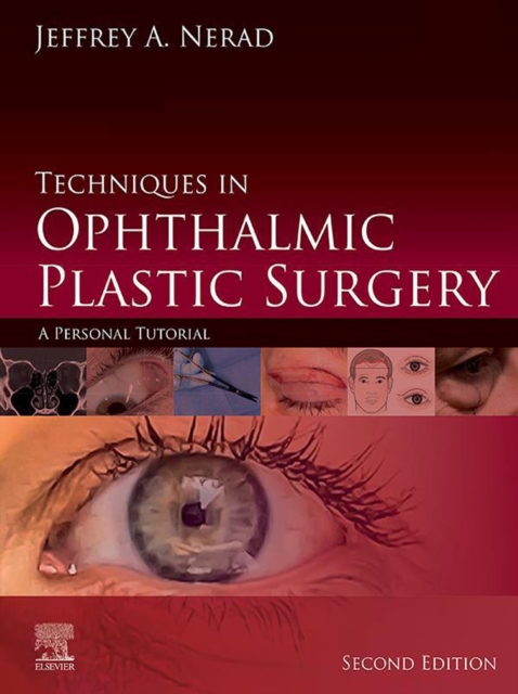 Techniques in Ophthalmic Plastic Surgery E-Book : A Personal Tutorial, EPUB eBook