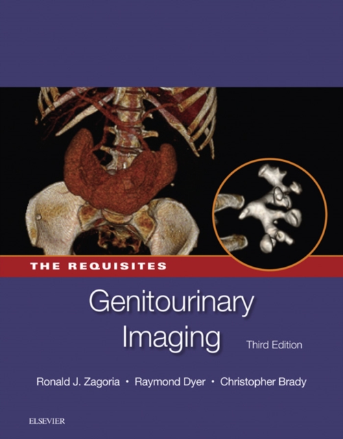Genitourinary Imaging: The Requisites E-Book : Genitourinary Imaging: The Requisites E-Book, EPUB eBook