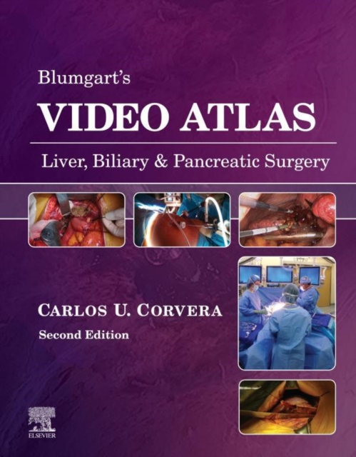 Blumgart's Video Atlas: Liver, Biliary & Pancreatic Surgery E-Book, EPUB eBook