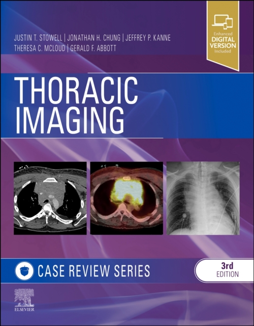 Thoracic Imaging: Case Review, Paperback / softback Book