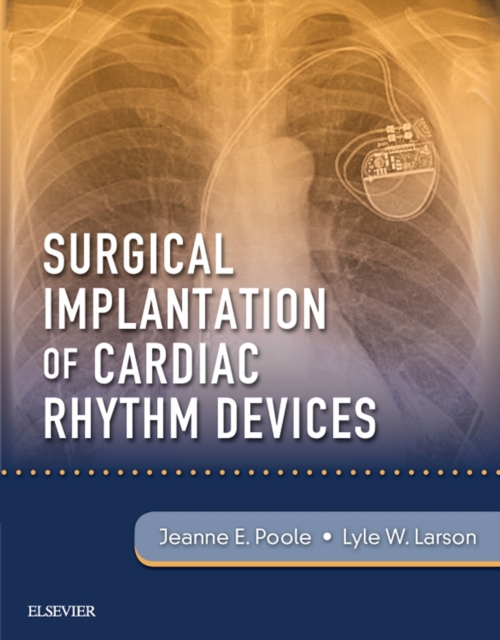 Surgical Implantation of Cardiac Rhythm Devices E-Book, EPUB eBook
