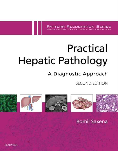 Practical Hepatic Pathology: A Diagnostic Approach E-Book : A Volume in the Pattern Recognition Series, EPUB eBook