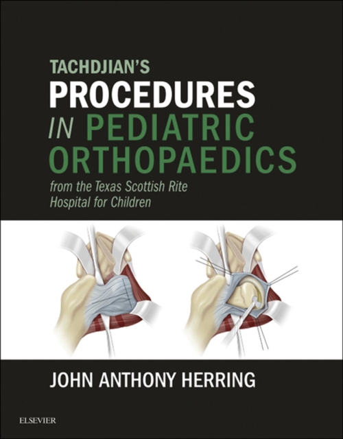 Tachdjian's Procedures in Pediatric Orthopaedics : From the Texas Scottish Rite Hospital for Children E-Book, EPUB eBook
