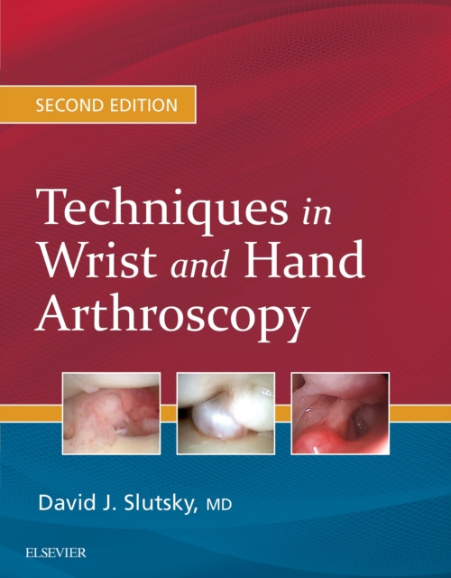 Techniques in Wrist and Hand Arthroscopy E-Book, PDF eBook