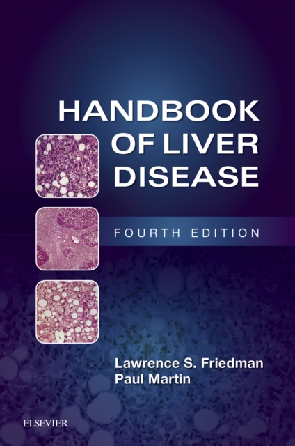 Handbook of Liver Disease, EPUB eBook
