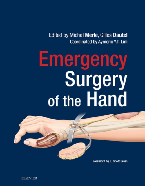 Emergency Surgery of the Hand E-Book, EPUB eBook